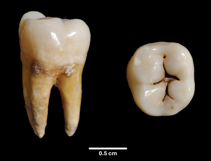 One of the sampled teeth viewed from various angles (Image: Roberto Germano)