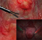 Un'immagine fornita dal simulatore di operazioni laparoscopiche in corso di sviluppo