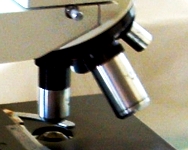 Nel nostro intestino una possibile cura per l'Alzheimer