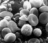 Trovato il gene responsabile di una malattia rara dovuta alla carenza di piastrine