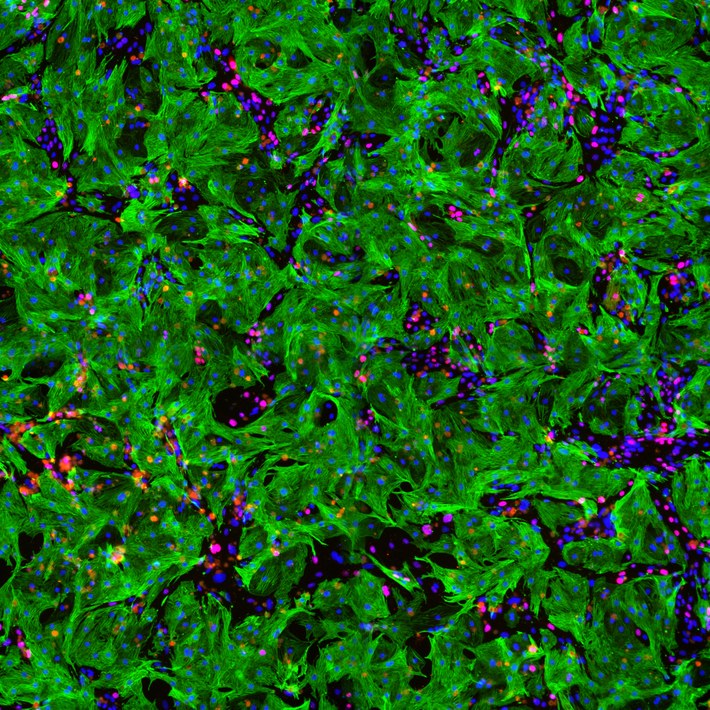 Cellule di cardiomiociti